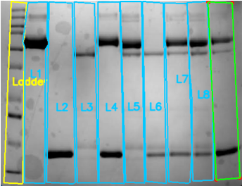 Annotated gel with ladder and lanes L2–L8 boxed for quantification